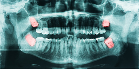 Digital Marketing for Cosmetic Dentists in the UK